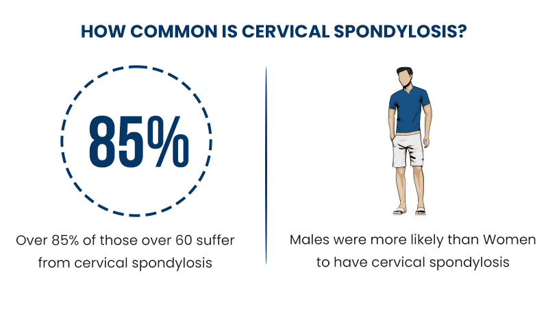 How Common is Cervical Spondylosis?