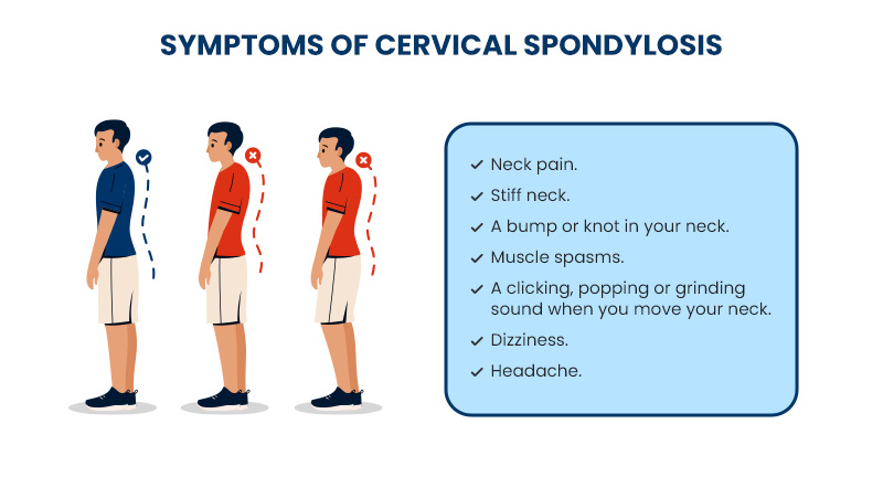 symptoms of cervical spondylosis